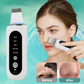 Ultrasonic Skin Scrubber – Deep Cleansing Blackhead Remover & Pore Cleaner, Facial Shovel Cleanser with Ion Technology for Acne and Peeling