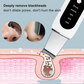 Ultrasonic Skin Scrubber – Deep Cleansing Blackhead Remover & Pore Cleaner, Facial Shovel Cleanser with Ion Technology for Acne and Peeling