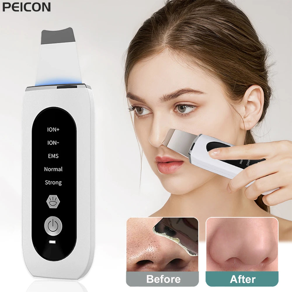 Ultrasonic Skin Scrubber – Deep Cleansing Blackhead Remover & Pore Cleaner, Facial Shovel Cleanser with Ion Technology for Acne and Peeling