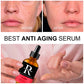 Organic Retinol Facial Serum: Whitening, Anti-Aging, Hyaluronic Acid Moisturizer