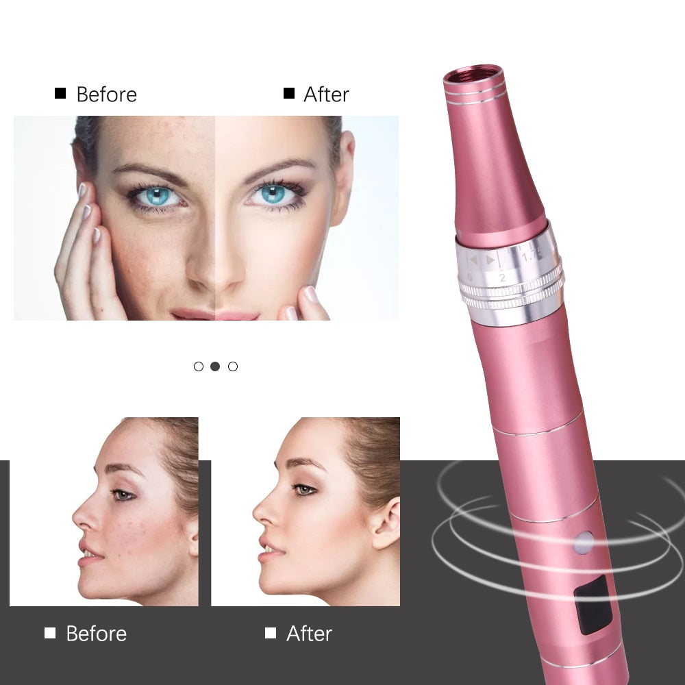 Ultima Wireless Dermapen Professional Microneedling Pen with Screw Cartridge for Auto Micro Needling and Mesotherapy"