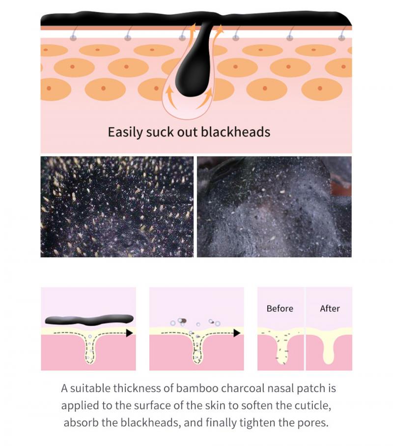 Blackhead Removal Nose  Strip T-Zone Face Care