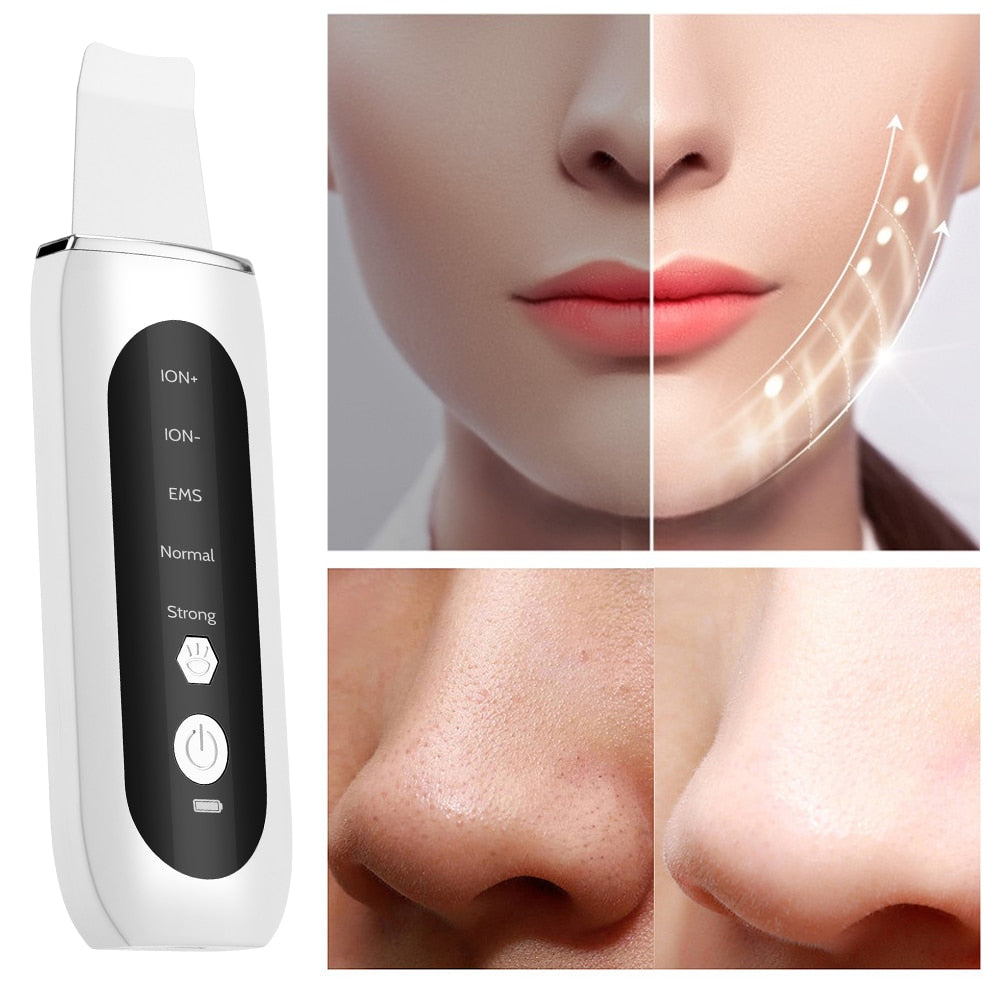 Advanced Facial Beauty Tool with Ultrasonic Scrubbing, EMS Micro-Current, Ion Import, Pore Cleaning, and Red/Blue Light Therapy for Skin Lifting and Rejuvenation